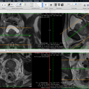 OsiriX screenshot