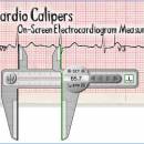 Cardio Calipers screenshot