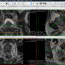 OsiriX download screenshot